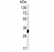 Western blot testing of mouse liver tissue lysate with ELOVL6 antibody. Predicted molecular weight ~31 kDa.
