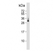 Western blot testing of human lung tissue lysate with ELOVL6 antibody. Predicted molecular weight ~31 kDa.