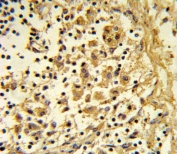 IHC testing of FFPE human lymph tissue with ENO1 antibody. HIER: steam section in pH6 citrate buffer for 20 min and allow to cool prior to staining.