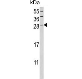 Western blot testing of human HL60 cell lysate with GZMB antibody. Predicted molecular weight: 29-37 kDa.