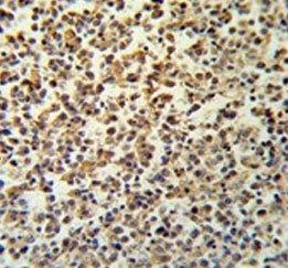 IHC testing of FFPE human lymph tissue with GZMB antibody. HIER: steam section in pH6 citrate buffer for 20 min and allow to cool prior to staining.