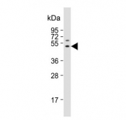 Western blot testing of human A431 cell lysate with FGG antibody. Predicted molecular weight ~52 kDa.