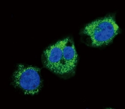 Immunofluorescent staining of human MDA-MB-231 cells with FGG antibody (green) and DAPI nuclear stain (blue).
