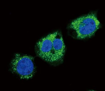 Immunofluorescent staining of human MDA-MB-231 cells with FGG antibody (green) and DAPI nuclear stain (blue).
