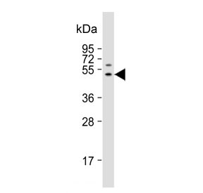 Western blot testing of human A431 cell lysate with FGG antibody. Predicted molecular weight ~52 kDa.