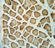 IHC testing of FFPE human skeletal muscle tissue with FGG antibody. HIER: steam section in pH6 citrate buffer for 20 min and allow to cool prior to staining.