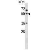 Western blot testing of human NIC-H460 cell lysate with FGG antibody. Predicted molecular weight ~52 kDa.