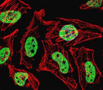 Immunofluorescent staining of fixed and permeabilized human HeLa cells with KLF6 antibody (green), DAPI nuclear stain (blue) and anti-Actin (red).