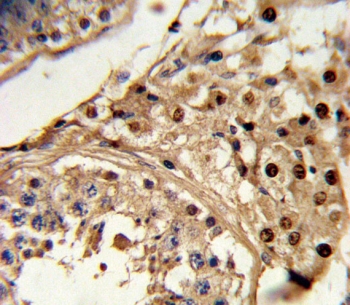 IHC testing of FFPE human testis tissue with KLF6 antibody. HIER: steam section in pH6 citrate buffer for 20 min and allow to cool prior to staining.
