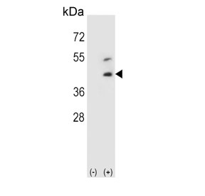 Western blot testing of 1) non-transfected and 2) transfected 293 cell lysate with DCN antibody.