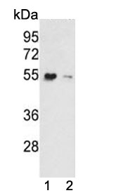 Western blot testing of human 1) Y79 and 2) T-47D cell lysate with EEF1A1/2 antibody. Predicted molecular weight ~50 kDa.