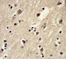 IHC testing of FFPE human brain tissue with EEF1A1/2 antibody. HIER: steam section in pH6 citrate buffer for 20 min and allow to cool prior to staining.