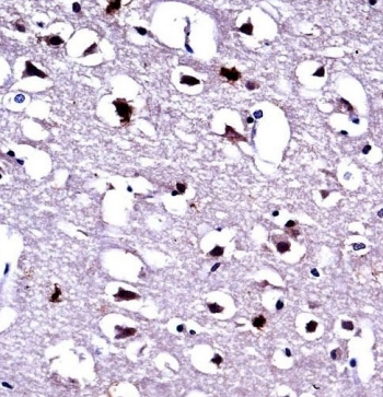 IHC testing of FFPE human brain tissue with EEF1A1/2 antibody. HIER: steam section in pH6 citrate buffer for 20 min and allow to cool prior to staining.