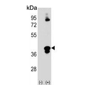 Western blot testing of 1) non-transfected and 2) transfected 293 cell lysate with C1QTNF1 antibody.