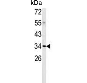 Western blot testing of human A2058 cell lysate with C1QTNF1 antibody. Predicted molecular weight ~32 kDa.