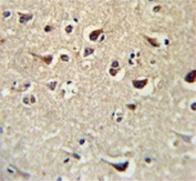 IHC testing of FFPE human brain tissue with KLF11 antibody. HIER: steam section in pH6 citrate buffer for 20 min and allow to cool prior to staining.