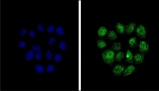 Immunofluorescent staining of human HeLa cells with KLF11 antibody (green) and DAPI nuclear stain (blue).