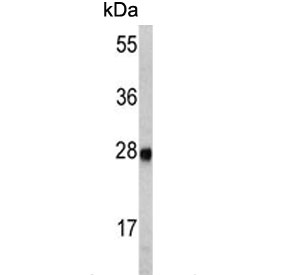 Western blot testing of mouse kidney tissue lysate with ETHE1 antibody. Predicted molecular weight ~28 kDa.