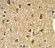 IHC testing of FFPE human brain tissue with PEA3 antibody. HIER: steam section in pH6 citrate buffer for 20 min and allow to cool prior to staining.