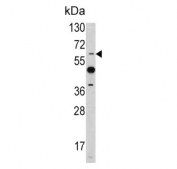 Western bloot testing of mouse heart tissue lysate with PEA3 antibody. Expected molecular weight: 54-61 kDa.