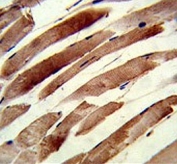 IHC testing of FFPE human skeletal muscle tissue with TAGLN antibody. HIER: steam section in pH6 citrate buffer for 20 min and allow to cool prior to staining.