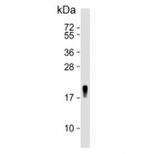 Western blot testing of human uterus tissue lysate with TAGLN antibody. Predicted molecular weight ~22 kDa.