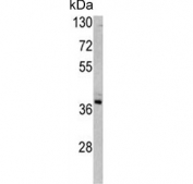 Western blot testing of human A375 cell lysate with Transaldolase antibody. Predicted molecular weight ~38 kDa.
