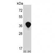 Western blot testing of 1) non-transfected and 2) transfected 293 cell lysate with Transaldolase antibody.