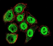 Immunofluorescent staining of human HeLa cells with TYSY antibody (green) and anti-Actin (red).