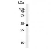 Western blot testing of human Jurkat cell lysate with TYSY antibody. Predicted molecular weight ~36 kDa.