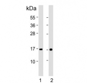 Western blot testing of human 1) placenta and 2) plasma lysate with Transthyretin antibody. Predicted molecular weight ~16 kDa.