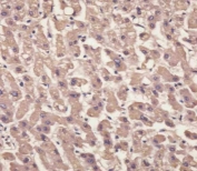IHC testing of FFPE human liver tissue with Transthyretin antibody. HIER: steam section in pH6 citrate buffer for 20 min and allow to cool prior to staining.