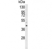 Western blot testing of human HL60 cell lysate with LRG1 antibody. Predicted molecular weight ~38 kDa.
