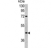 Western blot testing of human HEK293 cell lysate with Leucine-rich alpha-2-glycoprotein antibody. Predicted molecular weight ~38 kDa.