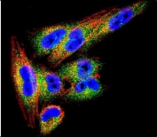 Immunofluorescent staining of human A2058 cells with TIMP1 antibody (green), DAPI nuclear stain (blue) and anti-Actin (red).