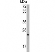 Western blot testing of human CCRF-CEM cell lysate with TIMP1 antibody. Predicted molecular weight ~23 kDa.