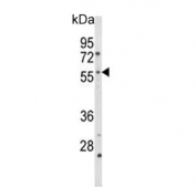 Western blot testing of human HL60 cell lysate with Cytochrome p450 2C19 antibody. Predicted molecular weight ~56 kDa.