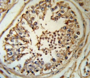 IHC testing of FFPE human testis tissue with Inhibin alpha antibody. HIER: steam section in pH6 citrate buffer for 20 min and allow to cool prior to staining.