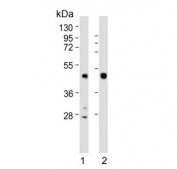 Western blot testing of 1) human SK-BR-3 and 2) mouse ovary lysate with Inhibin alpha antibody. Predicted molecular weight ~40 kDa.