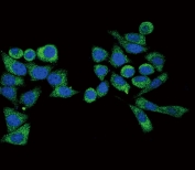Immunofluorescent staining of human HeLa cells with Galactosidase alpha antibody (green) and DAPI nuclear stain (blue).