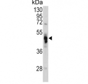 Western blot testing of human HeLa cell lysate with Galactosidase alpha antibody. Predicted molecular weight ~48 kDa.