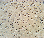 IHC testing of FFPE mouse brain tissue with HPRT1 antibody. HIER: steam section in pH6 citrate buffer for 20 min and allow to cool prior to staining.
