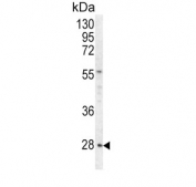 Western blot testing of human HeLa cell lysate with HPRT1 antibody. Predicted molecular weight ~25 kDa.