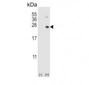 Western blot testing of 1) non-transfected and 2) transfected 293 cell lysate with HPRT1 antibody.