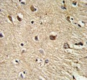IHC testing of FFPE human brain tissue with BGN antibody. HIER: steam section in pH6 citrate buffer for 20 min and allow to cool prior to staining.