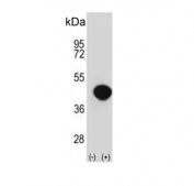 Western blot testing of 1) non-transfected and 2) transfected 293 cell lysate with BGN antibody.
