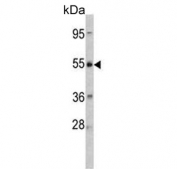 Western blot testing of human HeLa cell lysate with Corticotropin-releasing factor receptor 2 antibody. Predicted molecular weight ~48 kDa.