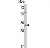 Western blot testing of human MDA-MB-231 cell lysate with HPGD antibody. Predicted molecular weight ~29 kDa.