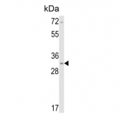 Western blot testing of human NCI-H460 cell lysate with Calponin 1 antibody. Predicted molecular weight ~33 kDa.