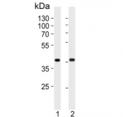 Western blot testing of human 1) HeLa and 2) MDA-MB-453 cell lysate with Calponin 1 antibody. Predicted molecular weight ~33 kDa.